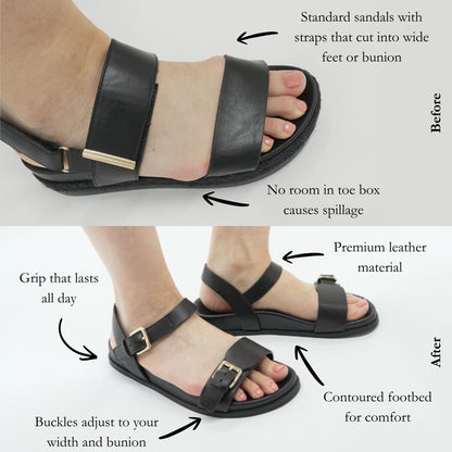 Solere sandal benefits for wide feet and bunions